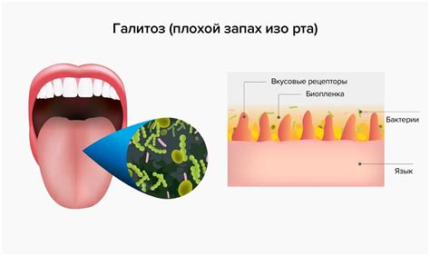 Неприятный запах изо рта: причины и последствия