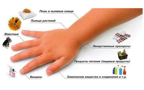 Нетрадиционные способы снятия ожога от перца на руках