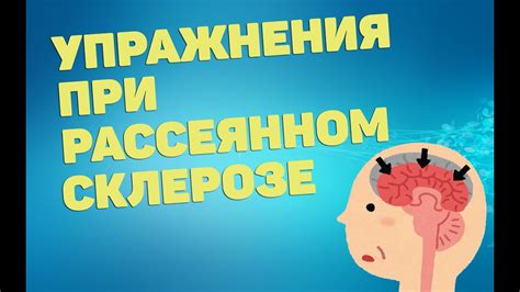 Общая рекомендация по употреблению алкоголя при рассеянном склерозе