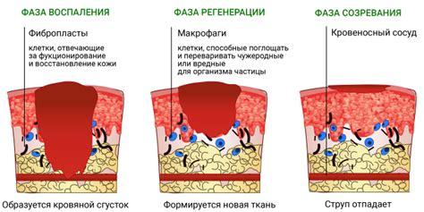 Ожоги: что это такое и как они возникают?