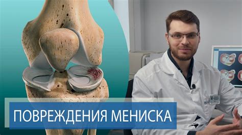 Опасности при разрыве мениска и способы облегчить боль