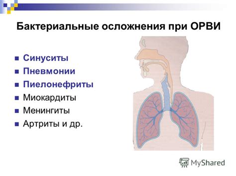 Операция при ОРВИ: возможны ли осложнения?