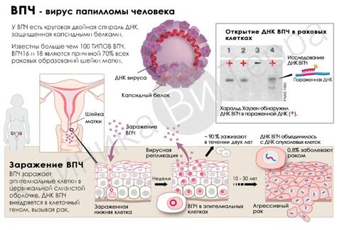 Определение ВПЧ в крови