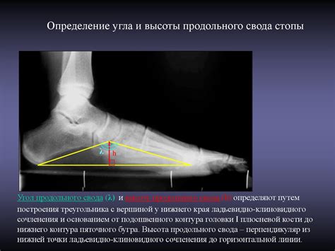 Определение широты стопы: лучшие методы и рекомендации