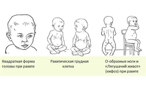 Определите симптомы проглатывания