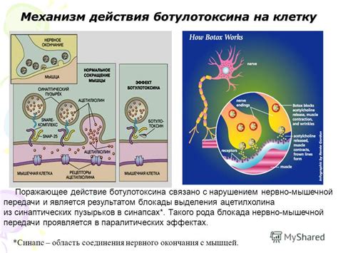 Оптимальное количество прокручиваний плойки и усиление действия ботулотоксина