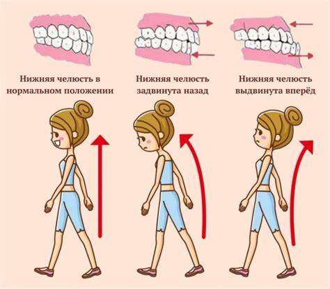 Осанка и ее влияние на прикус: миф или реальность?