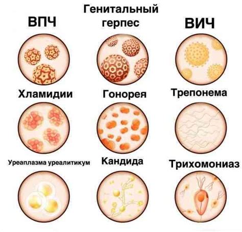 Основные виды заболеваний, передающихся клопами: