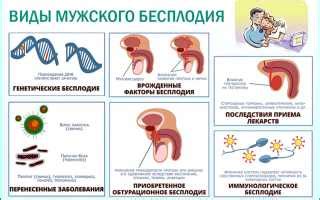 Основные признаки мужского бесплодия