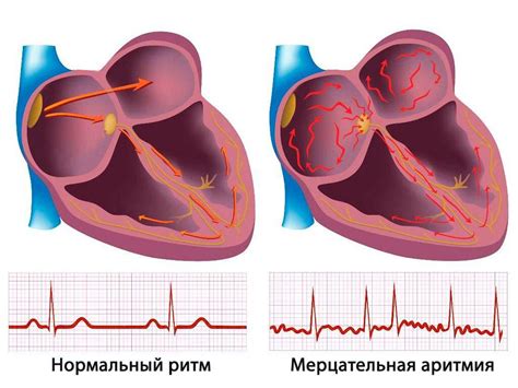 Основные причины отрыва легких