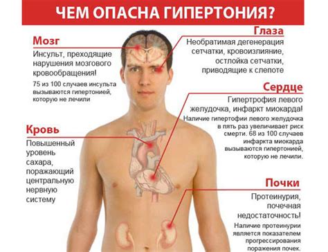 Основные симптомы гипертонии 1 степени