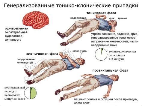 Основные шаги при судорогах