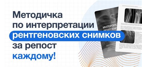 Особенности интерпретации рентгеновских снимков