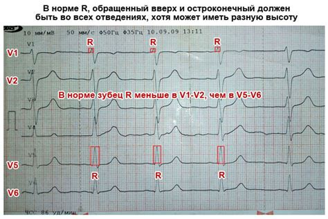 Особенности проведения ЭКГ у маленьких пациентов