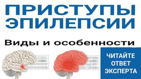 Особенности эпилепсии и воздействие на полет