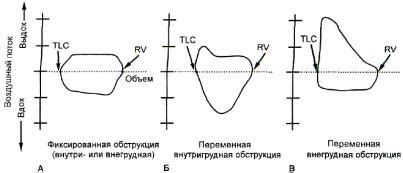 Оценка функции легких