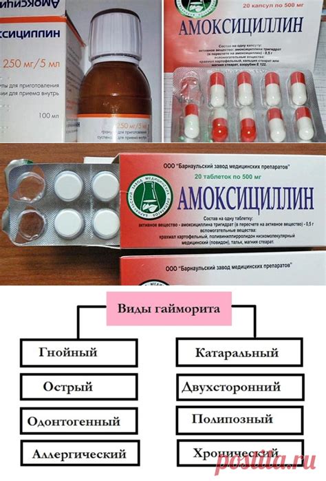 Плюсы и минусы отипакса при заложенности уха