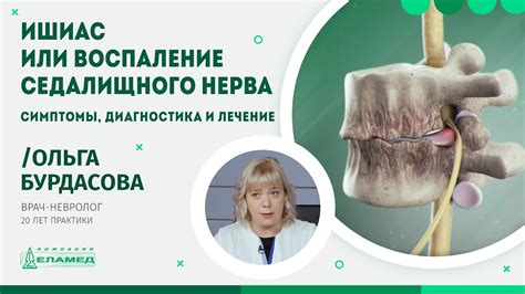 Повреждение седалищного нерва и его последствия