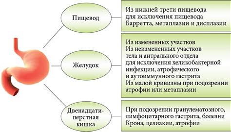 Повреждение слизистой оболочки желудка при курении