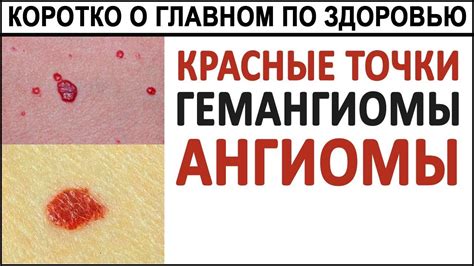 Понятие о загорании с красными точками