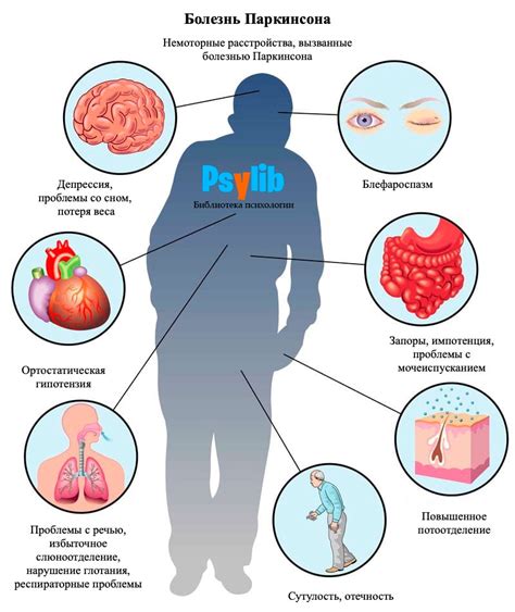 Понятие паркинсона и его проявления