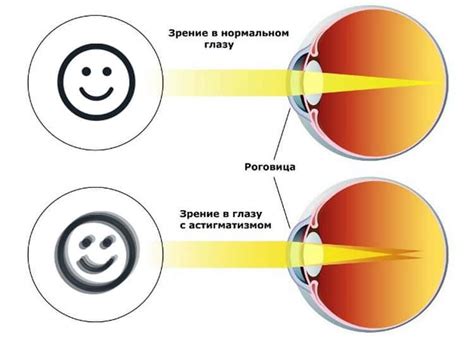 Последствия для глаз и зрения