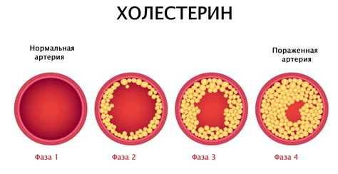 Последствия низкой и высокой чести