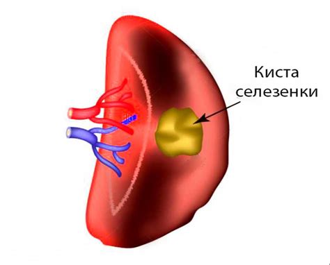 Потенциальные проблемы с грушей