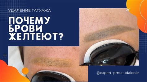 Почему брови вырастают после удаления?