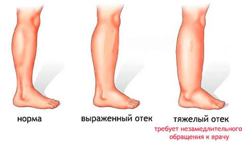 Почему ноги - основа подвижности нашего тела