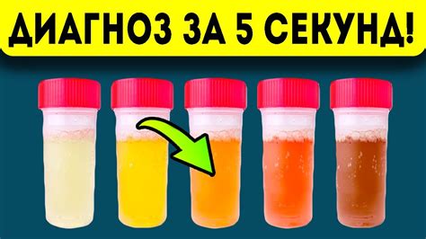 Почему утренняя моча рекомендуется?