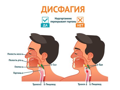 Появление дисфагии