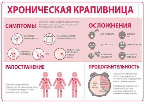 Преимущества и недостатки мытья при крапивнице