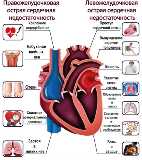 Признаки и диагностика сердечной недостаточности