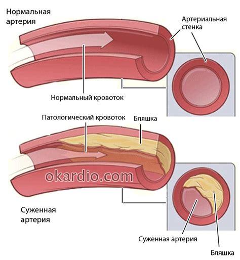 Признаки и симптомы закупорки протока