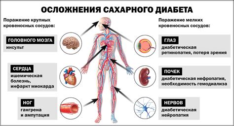 Признаки сахарного диабета 2 типа