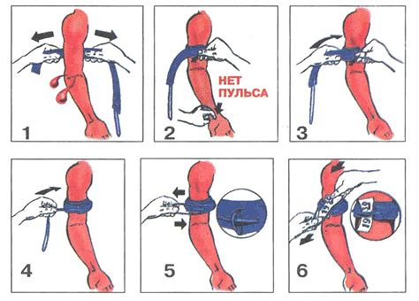 Принципы и деление: как действует жгут