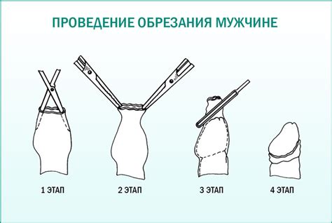 Причины, по которым молодые люди решаются на обрезание