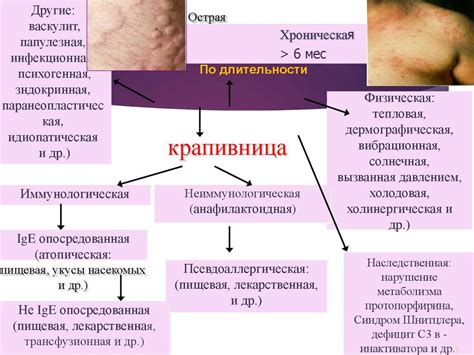 Причины возникновения крапивницы