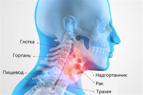 Причины и симптомы воспаления горла