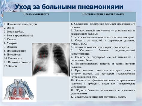 Причины и симптомы воспаления легких