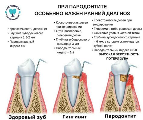 Причины и симптомы пародонтоза