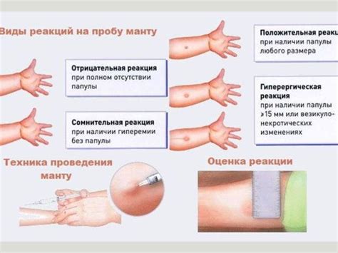 Проблемы диаскинтеста для ребенка