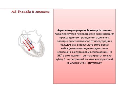 Противопоказания и ограничения в спорте при дисфункции синусового узла