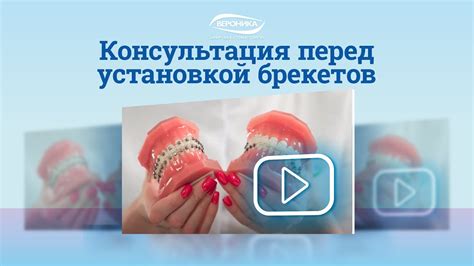 Профессиональная консультация перед установкой