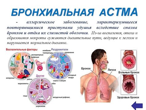 Профилактика астмы