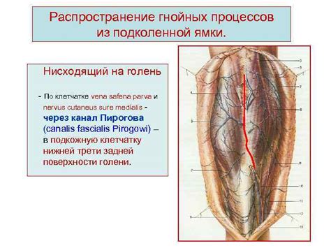 Профилактика гнойных процессов в лимфоузлах