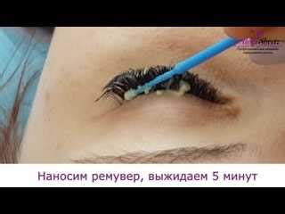 Процедура удаления гнойных нарощенных ресниц