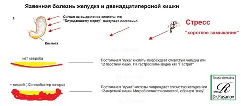 Психосоматические причины отрыжки