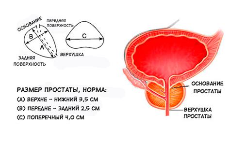 Размер предстательной железы